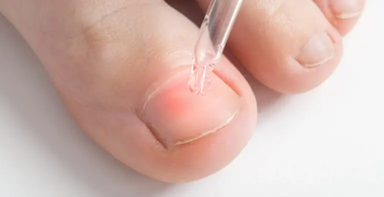 grzybki na wykałaczkach przyklejone do paznokci u stóp
